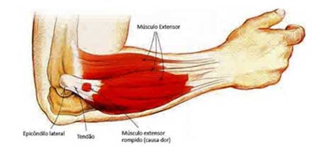 motogp-esforco-fisico